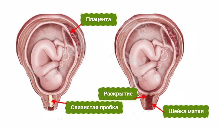 Определение цвета выделений при отходе пробки у женщин во время беременности